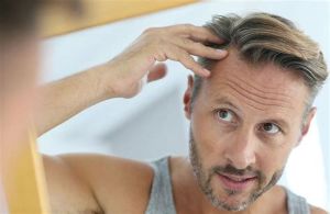 男性脱髮是什麼原因及治療