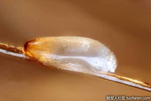 死蝨子卵是什麼樣的？