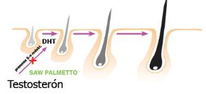 鋸棕櫚和DHT之間有什麼聯繫？