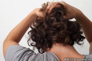 糖尿病會導致脱髮嗎？