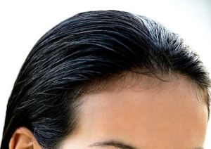如何在後退髮際上重新長髮