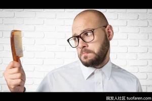 總結三點脱髮常見問題