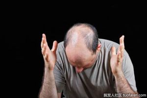 碘是如何幫助扭轉脱髮的