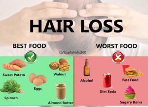防止脱髮的飲食有哪些