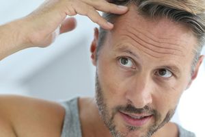 遺傳性脱髮可以治療嗎?