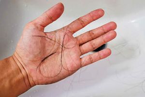 假髮對頭髮生長的影響