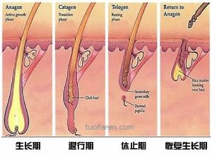 什麼是休止期脱髮 休止期脱髮的症狀