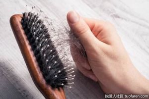 減緩脱髮的小貼士