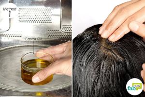 能用蓖麻油治療頭皮上的牛皮癬嗎?