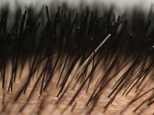 什麼是導致頭皮乾燥的原因?