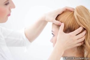 如何去除頭皮囊腫？