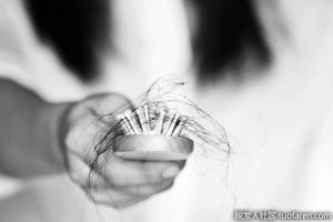 脱髮可能發生在你身上的5個原因