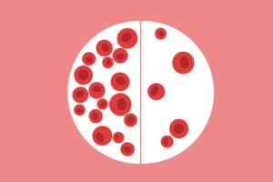 缺鐵性貧血有哪些症狀?