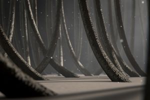 是什麼引起頭皮脂溢性皮炎?