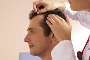 如何停止頭髮稀疏？