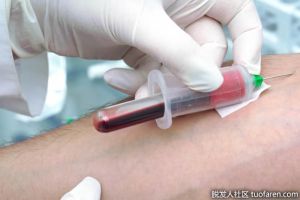 什麼是維生素D25？