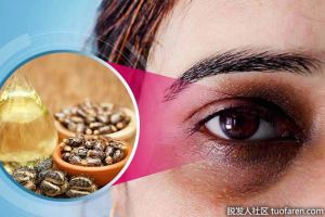 用蓖麻油來治療黑眼圈