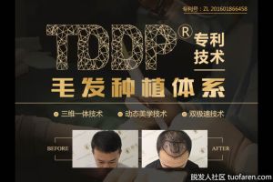 新生植髮：植髮價格，決定植髮價格的因素