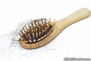 雌激素與女性脱髮的關係