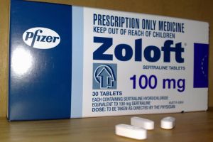 舍曲林和脱髮之間有聯繫嗎?