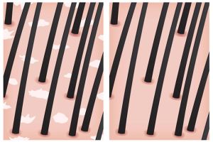 乾燥的頭皮和頭皮屑