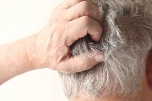 【組圖】如何去除毛蟎