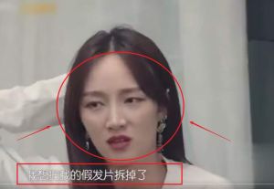 假髮片都救不了孟佳？如何解決脱髮問題