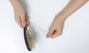 頭髮稀少的原因 頭髮稀少怎麼辦才好