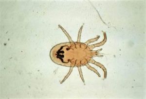 生活在人類頭髮中的蟎蟲