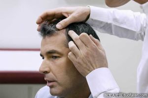 導致脱髮的頭皮疾病