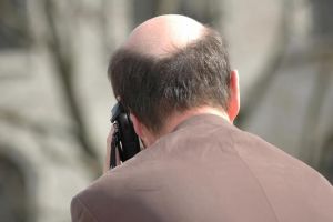 是什麼導致男性型禿髮