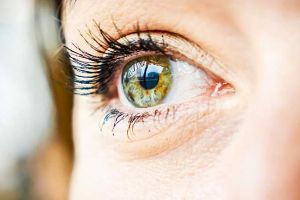 什麼導致睫毛變白？