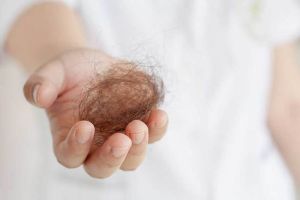 脱髮是什麼原因？