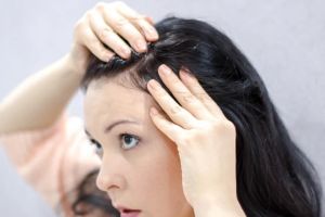 什麼是不同類型的頭皮狀況?