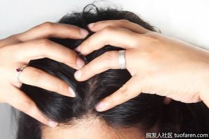 頭皮按摩，促進頭髮生長