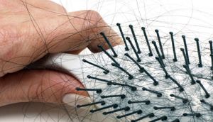 米諾地爾治療男性和女性脱髮