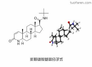 非那雄胺副作用和禁忌