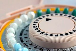 避孕藥會導致脱髮嗎？