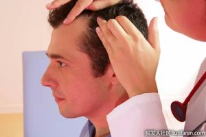 什麼樣的醫生治療脱髮？