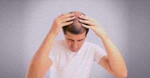 休止期脱髮的七種治療方法