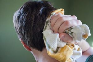 你頭上的粉刺會導致脱髮嗎?