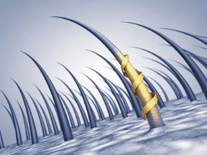 DHT頭皮脱髮治療