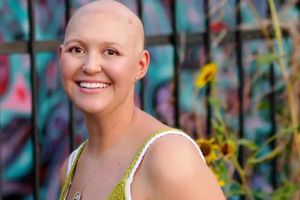 手術後脱髮的原因是什麼?