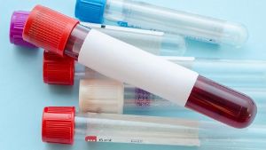 貧血會使你的頭髮變薄嗎？