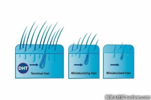 DHT是什麼意思？