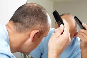 如何用天然的脱髮藥物來阻止脱髮