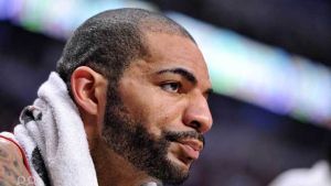 男性髮際線後退的解決方案