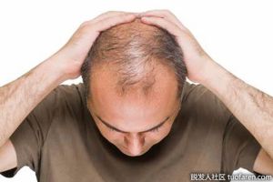 DHT如何影響男人的健康？