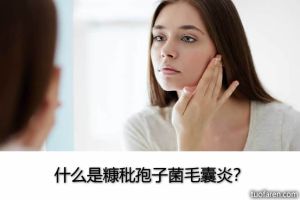 什麼是糠秕孢子菌毛囊炎？