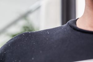 解決頭皮發癢、頭屑的方法